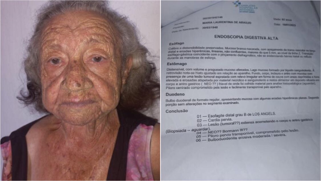 Família de idosa de 83 anos diagnosticada com câncer agressivo no estômago faz campanha para custear cirurgia de cerca de R$ 22 mil. Veja como ajudar