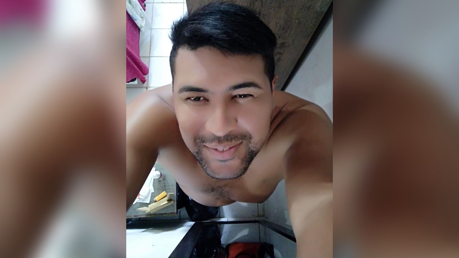 Após sofrer acidente, cidadão de Patos precisa fazer tomografia com urgência e faz apelo à Secretaria Municipal de Saúde