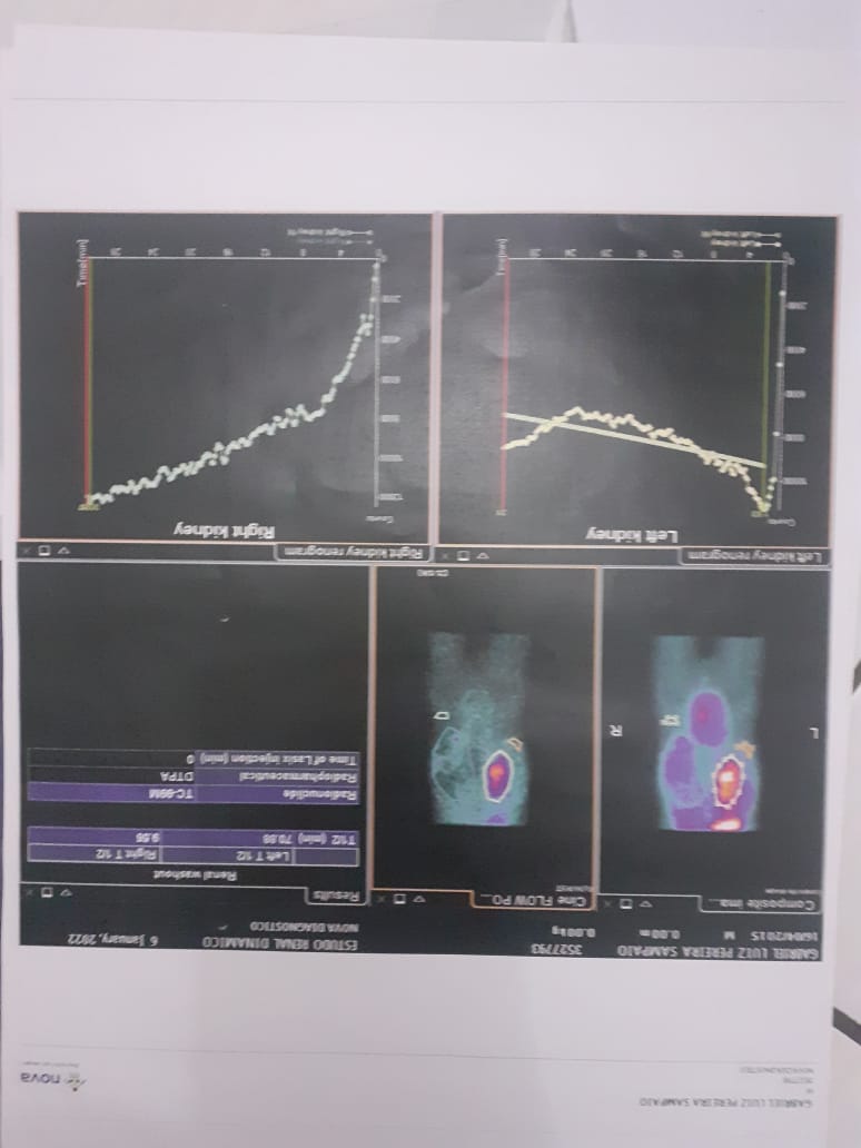 Em Patos: Mulher pede ajuda financeira para custear cirurgia do filho ainda criança. Confira