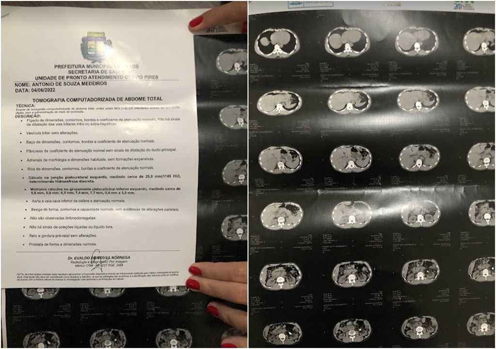 Em Patos: Paciente renal aguarda cirurgia há 1 ano e pede ajuda. Secretaria de Saúde e 6ª Gerência de Saúde se pronunciam