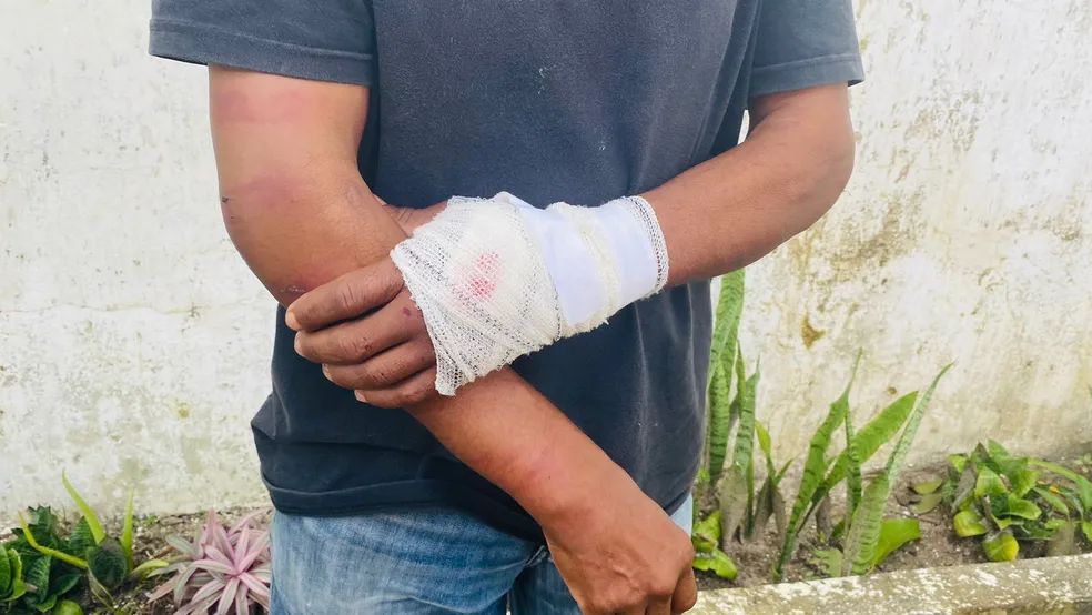 Homem suspeito de roubo é torturado com marteladas nas mãos, na Paraíba