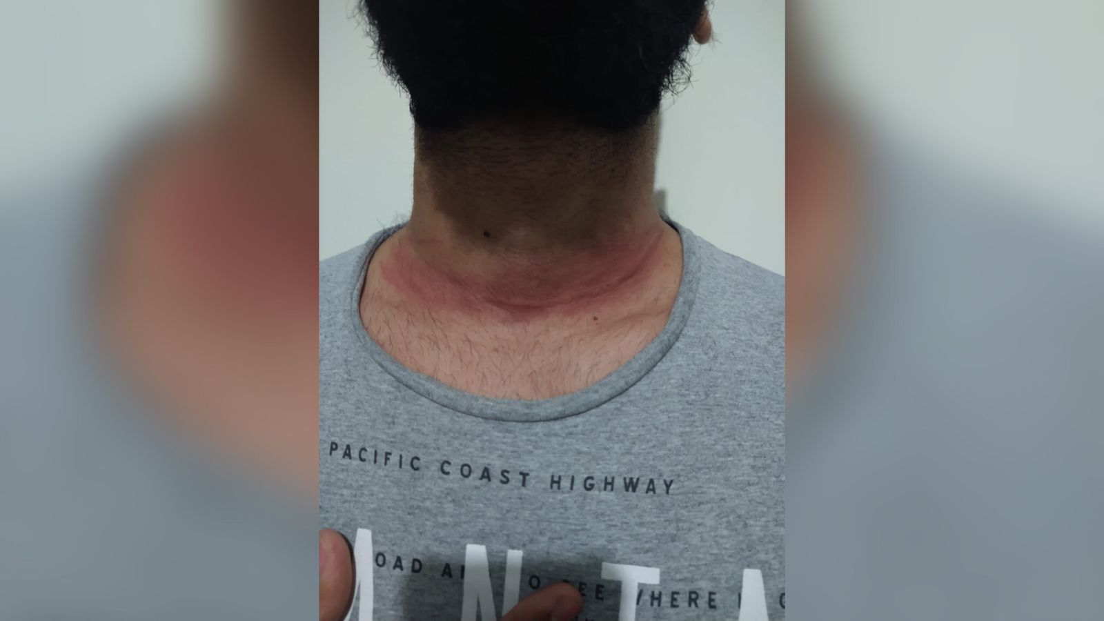 Em Patos: Motociclista diz que teve linha de pipa enroscada no pescoço e por pouco não sofreu grave acidente na noite desta quarta-feira (02)