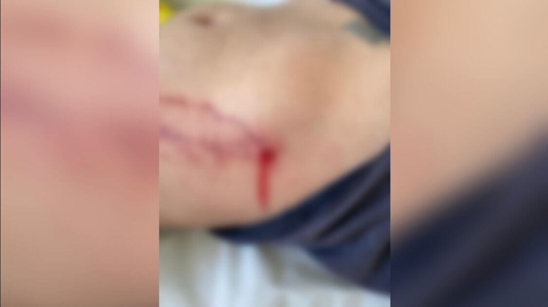 Briga entre detentos na Cadeia de Piancó deixa um ferido