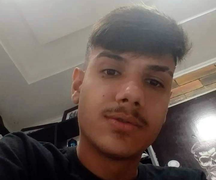 Jovem vítima de incêndio em residência na noite da última sexta-feira (04), em Patos, não resiste e morre no Hospital de Trauma de Campina Grande