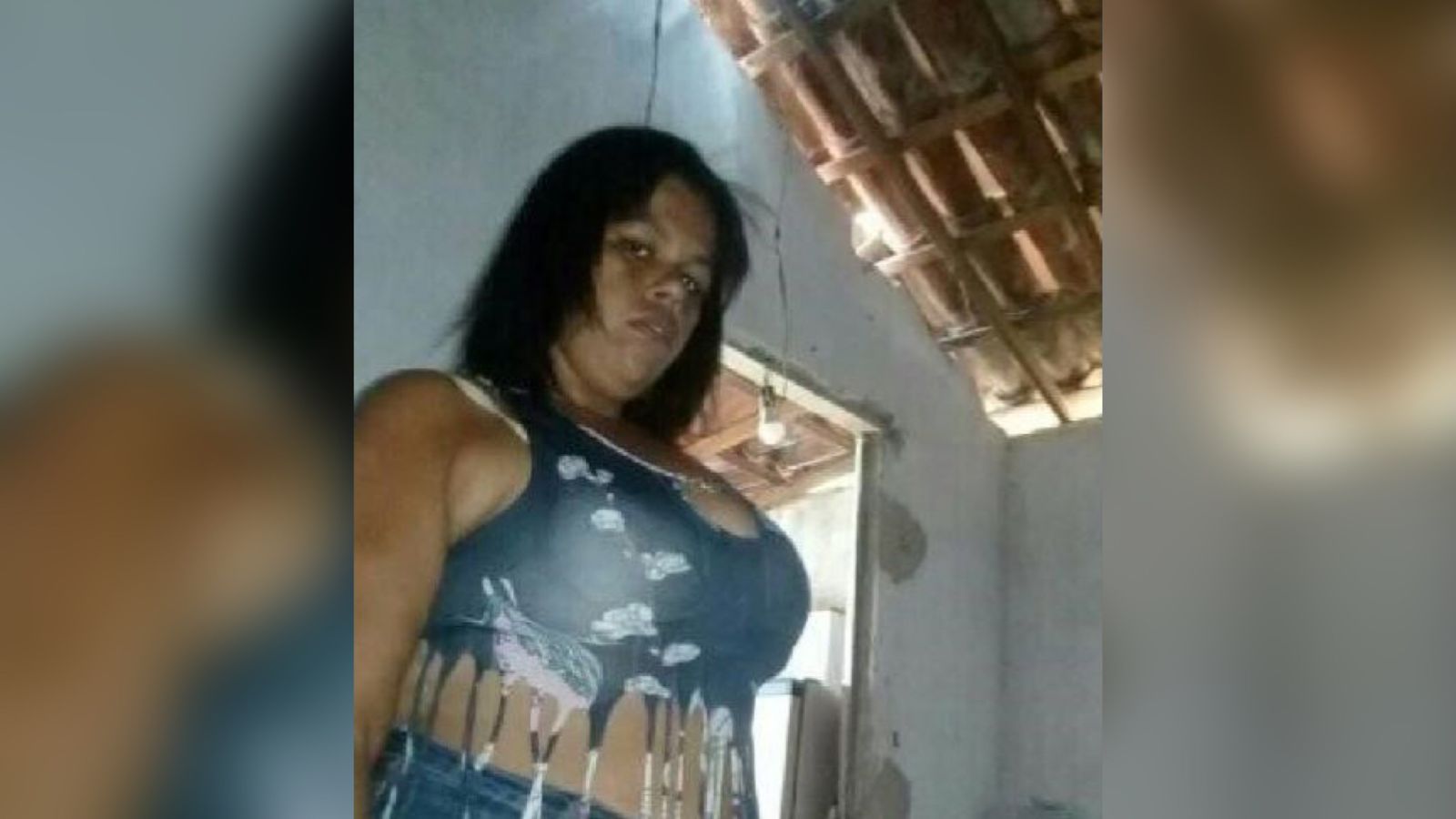 Em Patos: Jovem grávida que vive em situação de vulnerabilidade sofre graves queimaduras e tem 80% do corpo queimado ao tentar cozinhar usando álcool