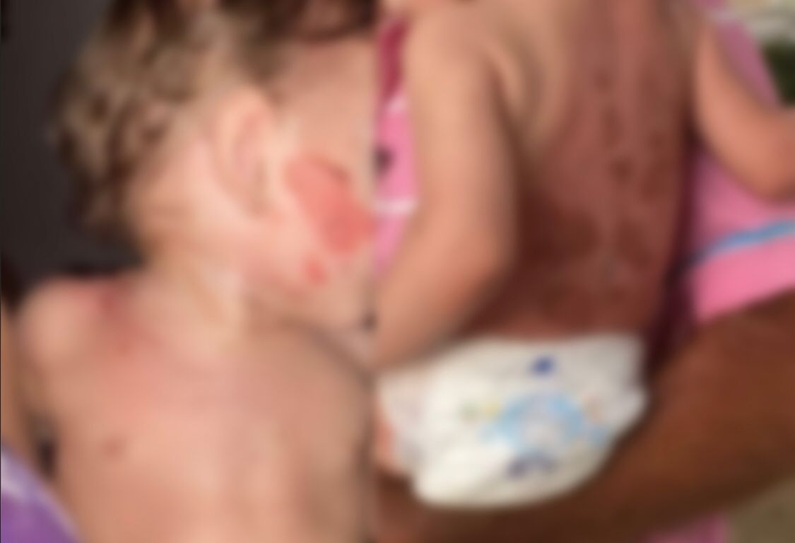 Crime bárbaro choca comunidade do Monte Castelo, em Patos: casal é preso sob acusação de tortura contra criança de apenas 1 ano