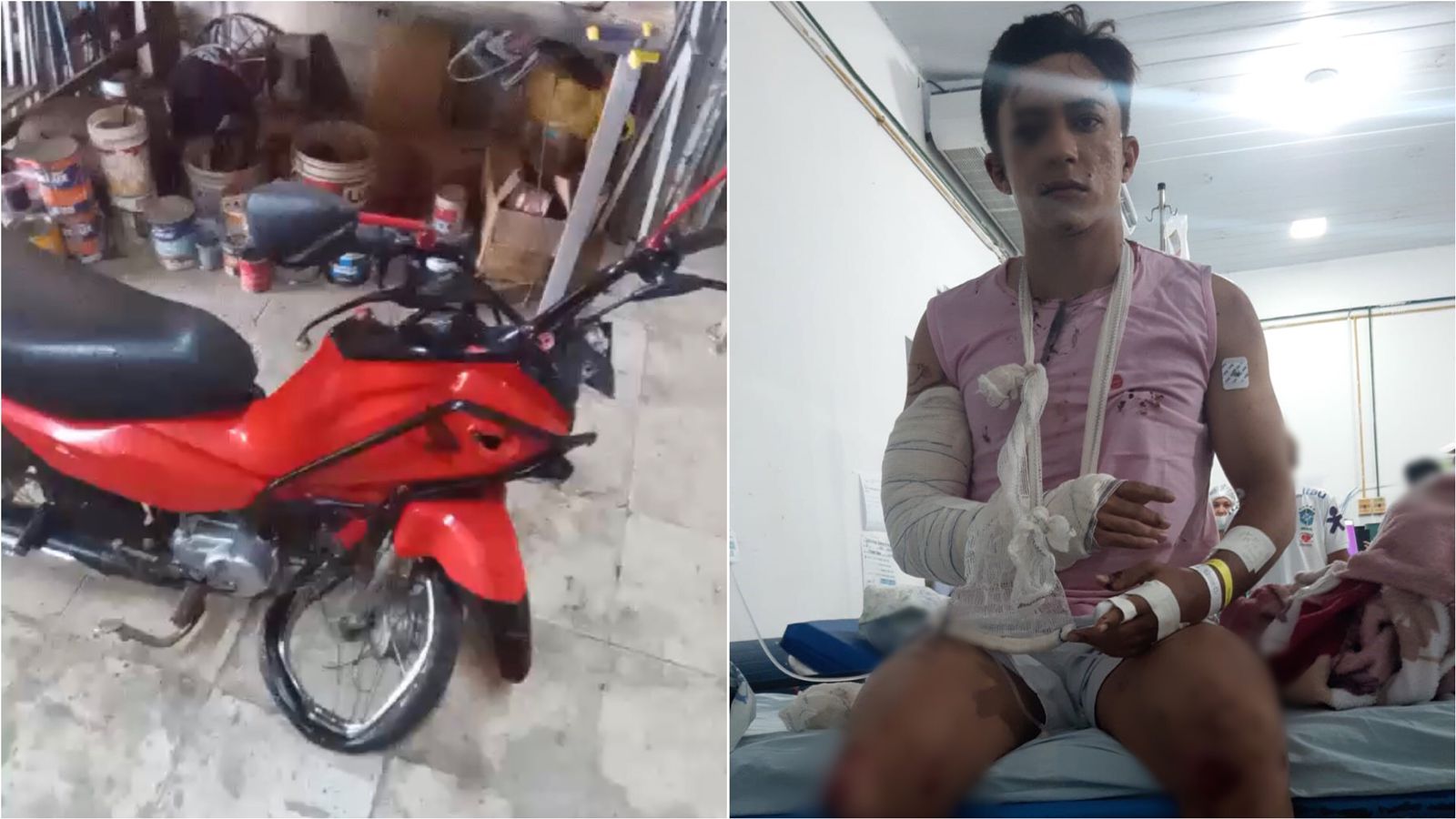 Jovem vítima de acidente na noite do último sábado (16), em Patos, está internado no Hospital Regional e precisa de doações de sangue; motorista fugiu sem prestar socorro