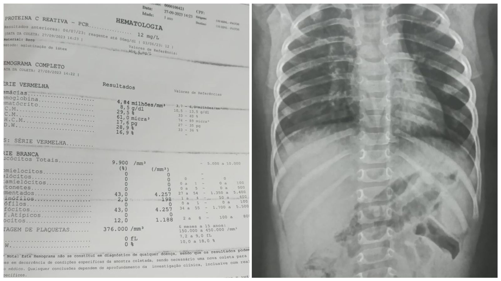 Em Patos, mãe faz apelo por ajuda no tratamento do filho enquanto família enfrenta dificuldades. Saiba como ajudar