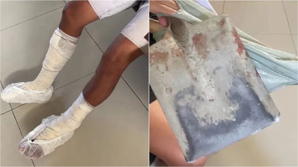 Homem é preso em João Pessoa, suspeito de quebrar pá nas pernas do filho