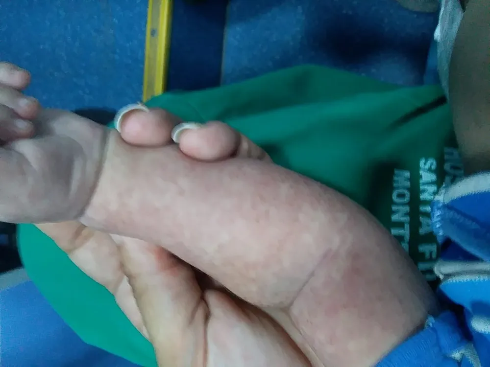 Mãe denuncia que bebê teria recebido injeção que teria prejudicado estado de saúde da criança — Foto: Arquivo pessoal 