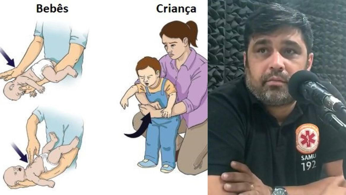 Coordenador do NEP do SAMU de Patos destaca importância dos Primeiros Socorros nas escolas e a manobra de Heimlich para situações de engasgo