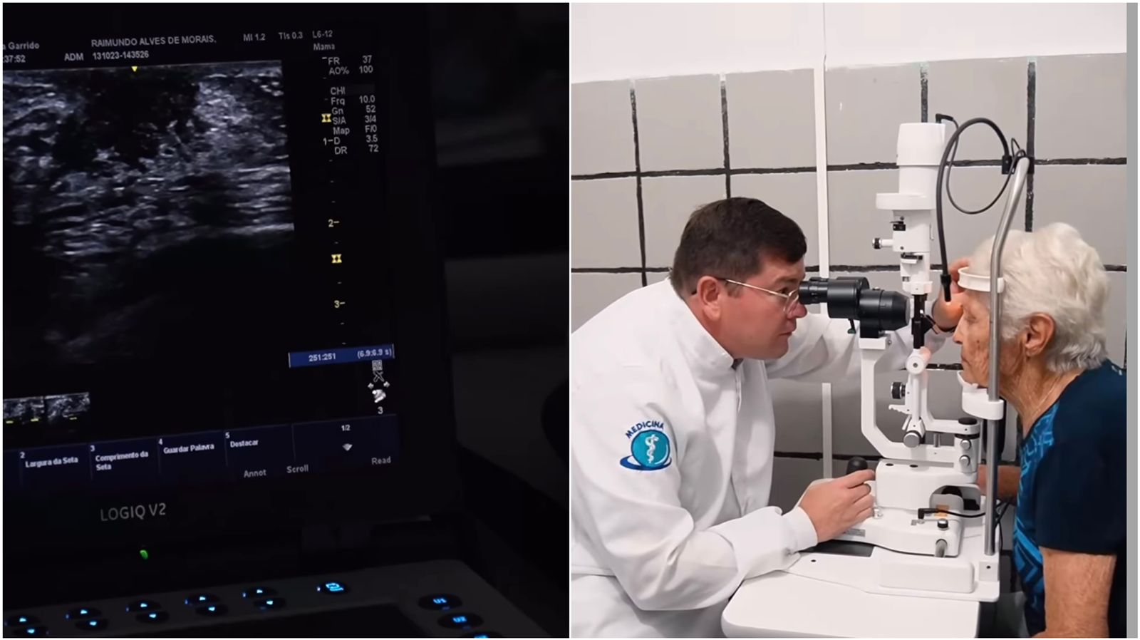 São Mamede realiza atendimentos com consultas Oftalmológicas e Ultrassonografias na última sexta-feira (13)