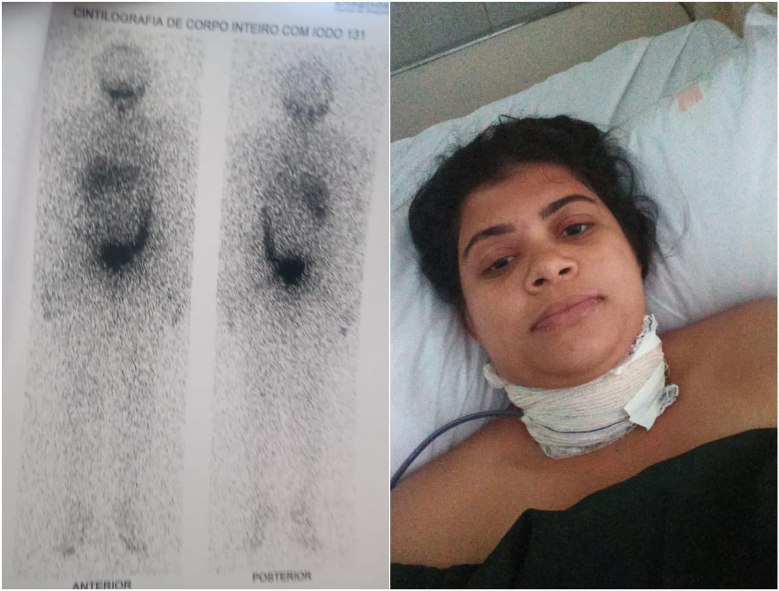 Mãe de três filhos enfrenta câncer e busca auxílio diante de desafios financeiros na cidade de Patos; Saiba como ajudar