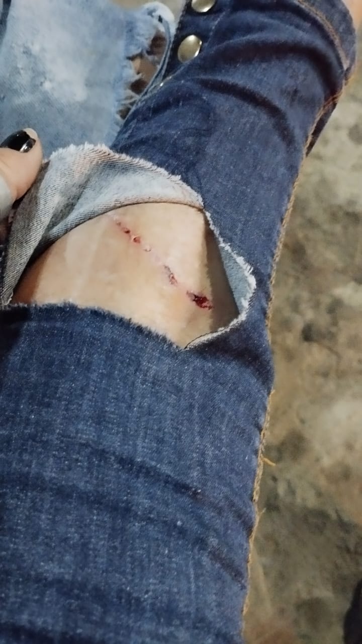 Internauta relata indignação após ser atacada por cão de rua enquanto retornava do trabalho, no Centro de Patos