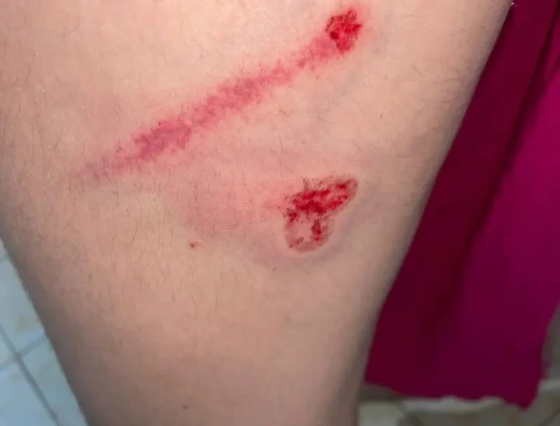 Jovem salta de carro em movimento para escapar de estupro, na Paraíba