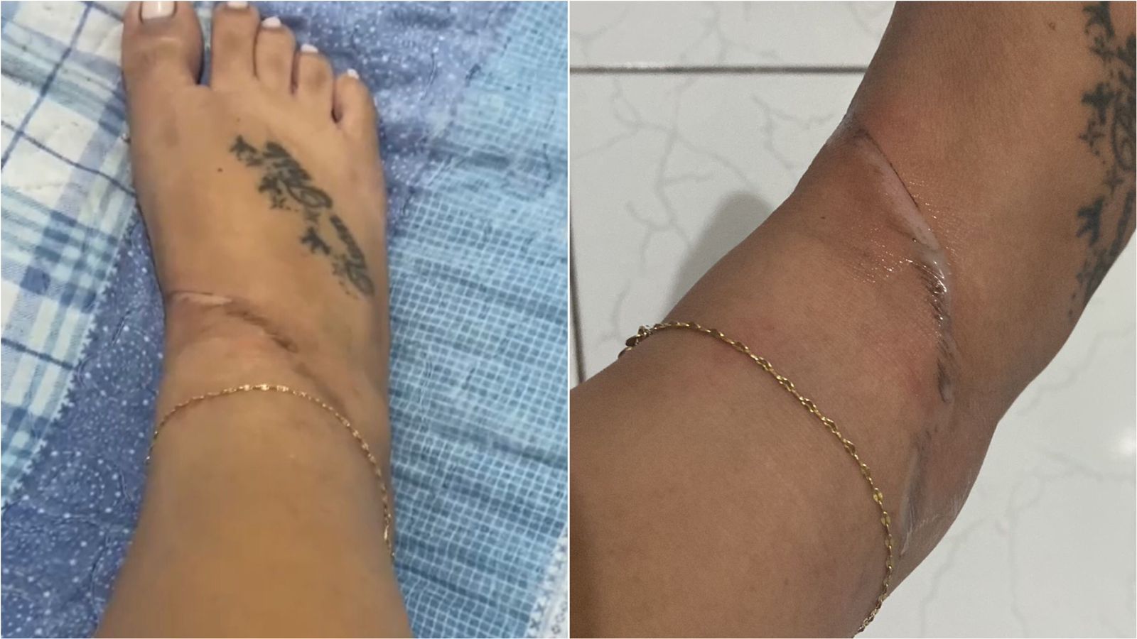 Motociclista relata que quase sofreu acidente após se enroscar em fios de telefone soltos na Rua Manoel Mota, no bairro Jatobá, em Patos