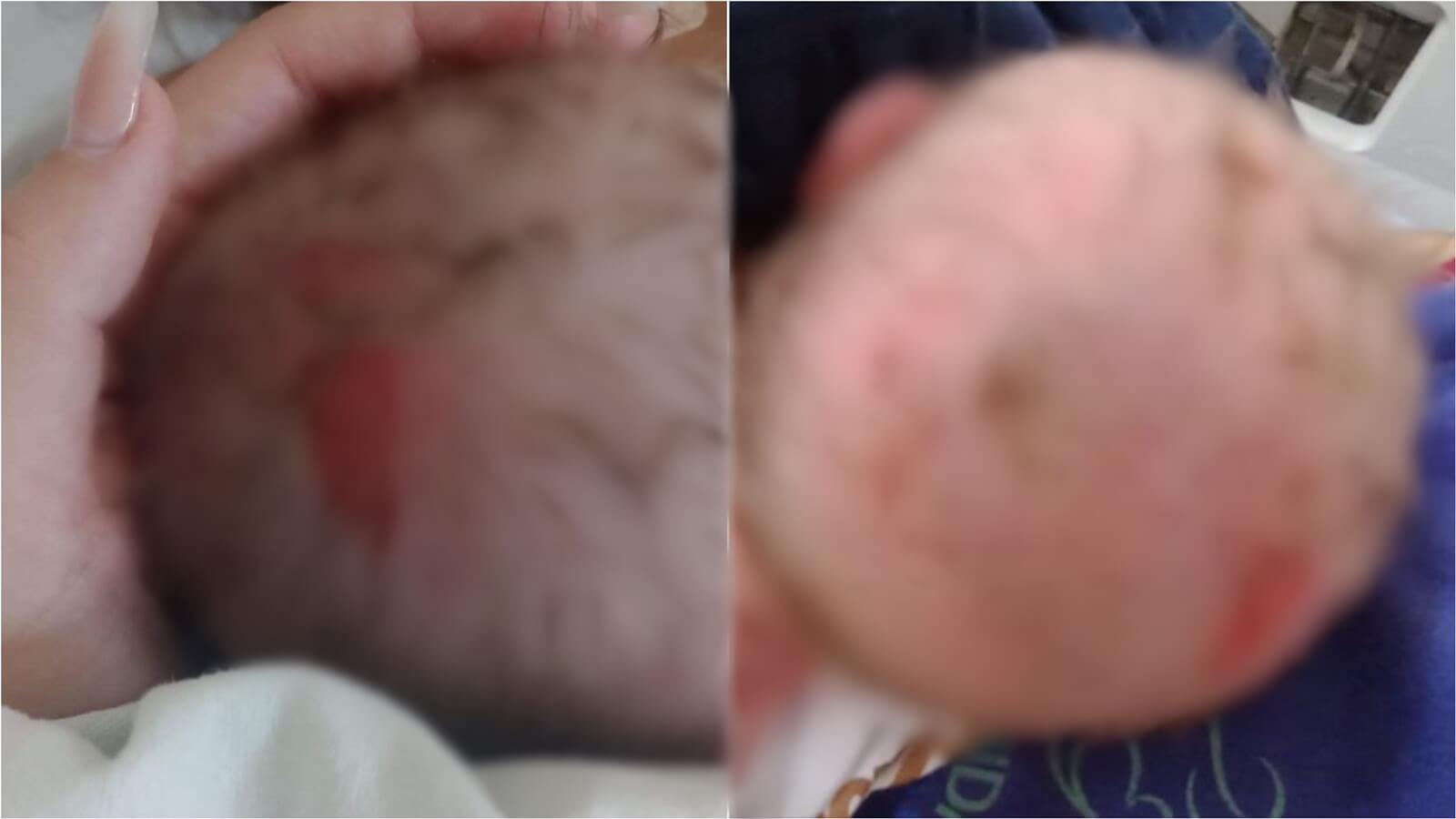 Pais denunciam que bebê sofreu ferimentos na cabeça após tentativa de parto normal na Maternidade de Patos; direção emite nota