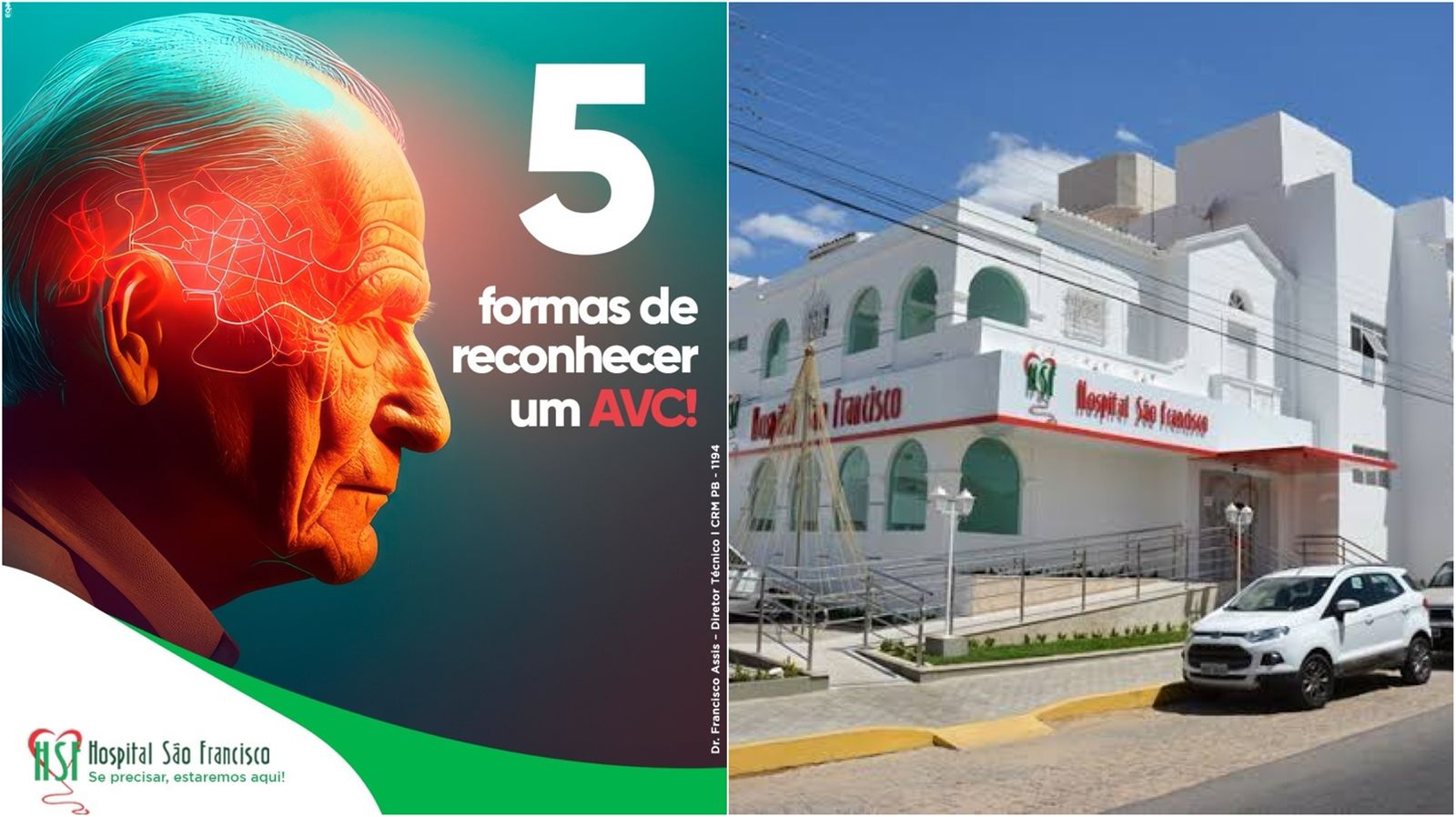 Hospital São Francisco orienta como Identificar um AVC e agir com rapidez; Confira as dicas