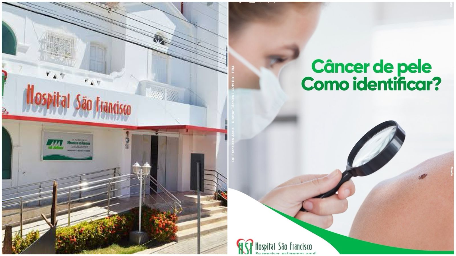 Hospital São Francisco de Patos alerta sobre identificação do câncer de pele no verão; veja