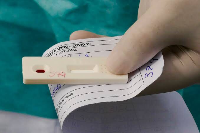 Secretário Municipal de Saúde confirma aumento de casos da covid-19 em Patos; ouça