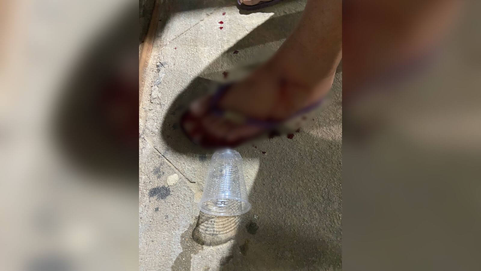 Adolescente de 16 anos sofre disparo de arma de fogo no pé em tentativa de assalto na noite desta segunda-feira (08), em Patos