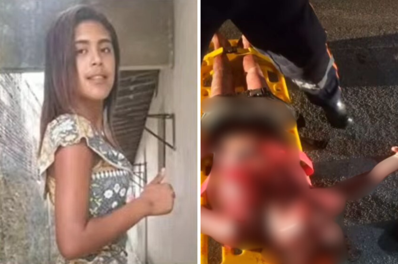 Na Paraíba: Jovem tem couro cabeludo arrancado em tentativa de feminicídio e ex-companheiro é o suspeito