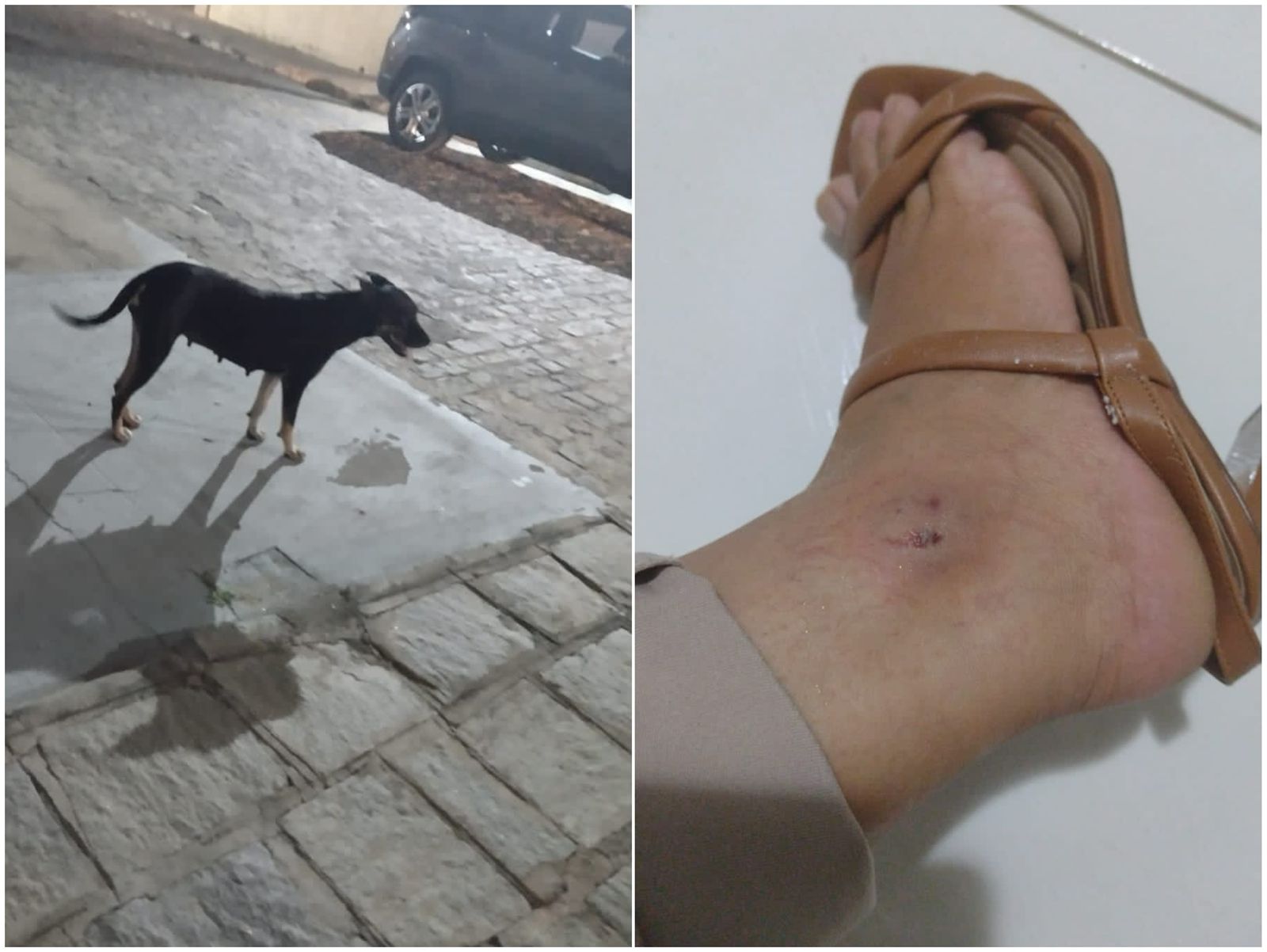 Em Patos, moradora é alvo de novo ataque de cachorro na cidade