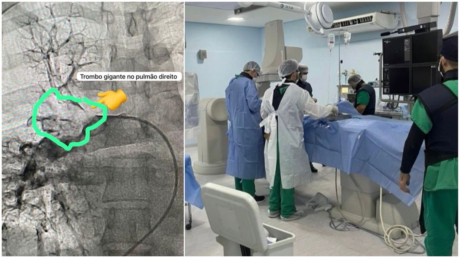 Cardiologista comenta procedimento bem-sucedido realizado pela Hemodinâmica de Patos