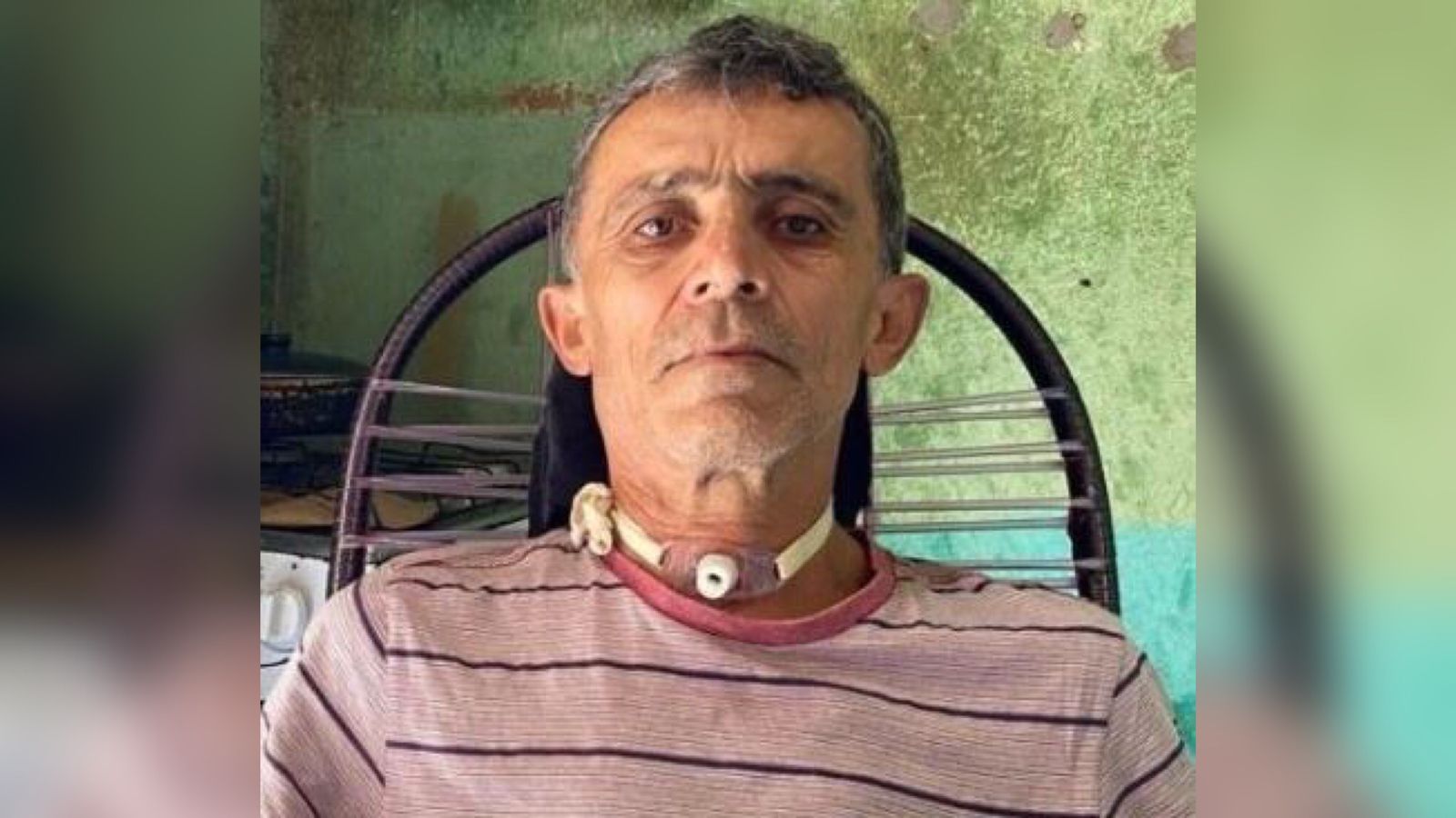 Família cria campanha solidária para conseguir realizar cirurgia urgente de patoense diagnosticado com câncer na garganta