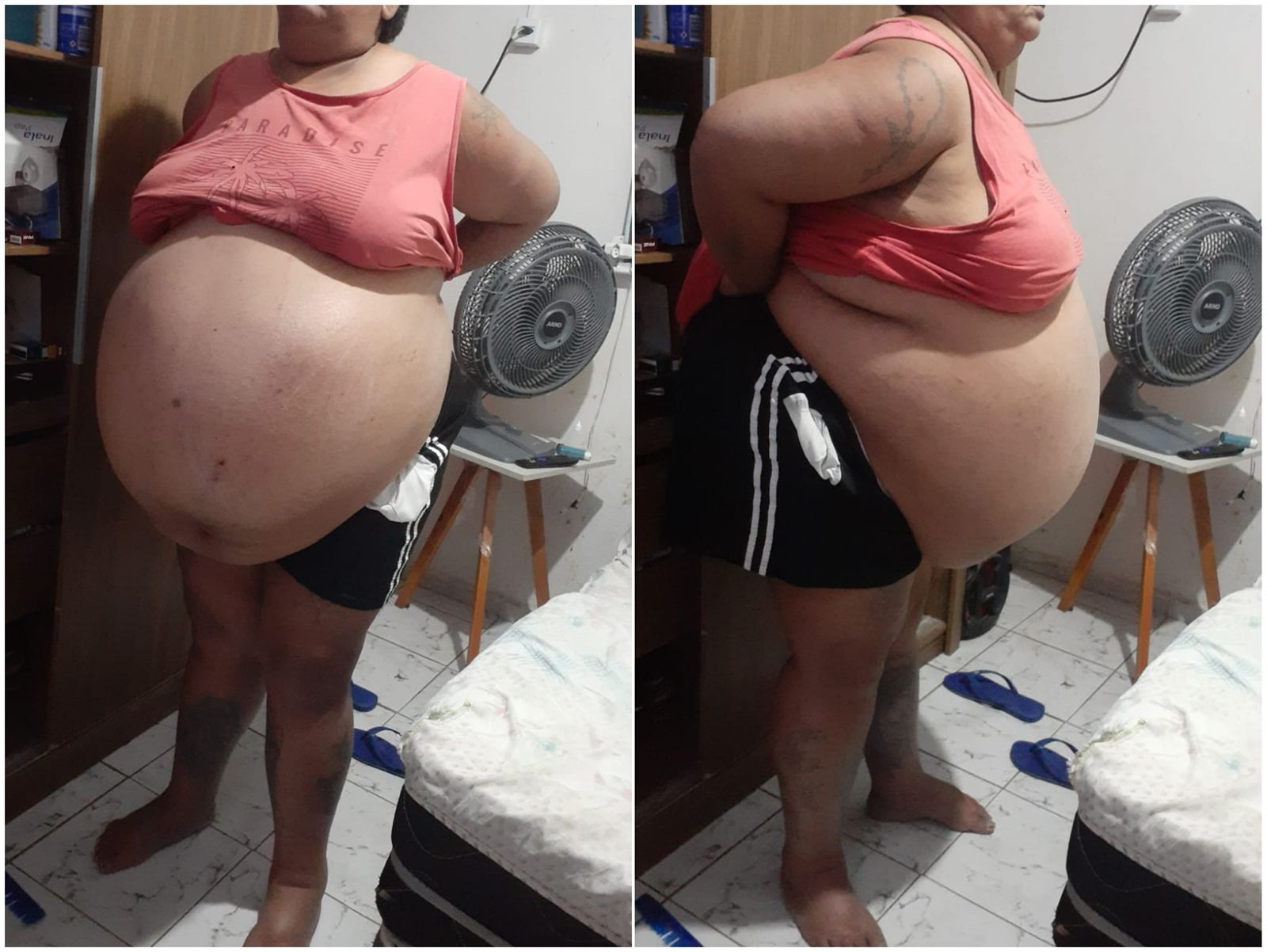 Patoense que está em tratamento de mioma e impossibilitada de trabalhar reforça campanha para conseguir alimentação e produtos de higiene; veja como contribuir