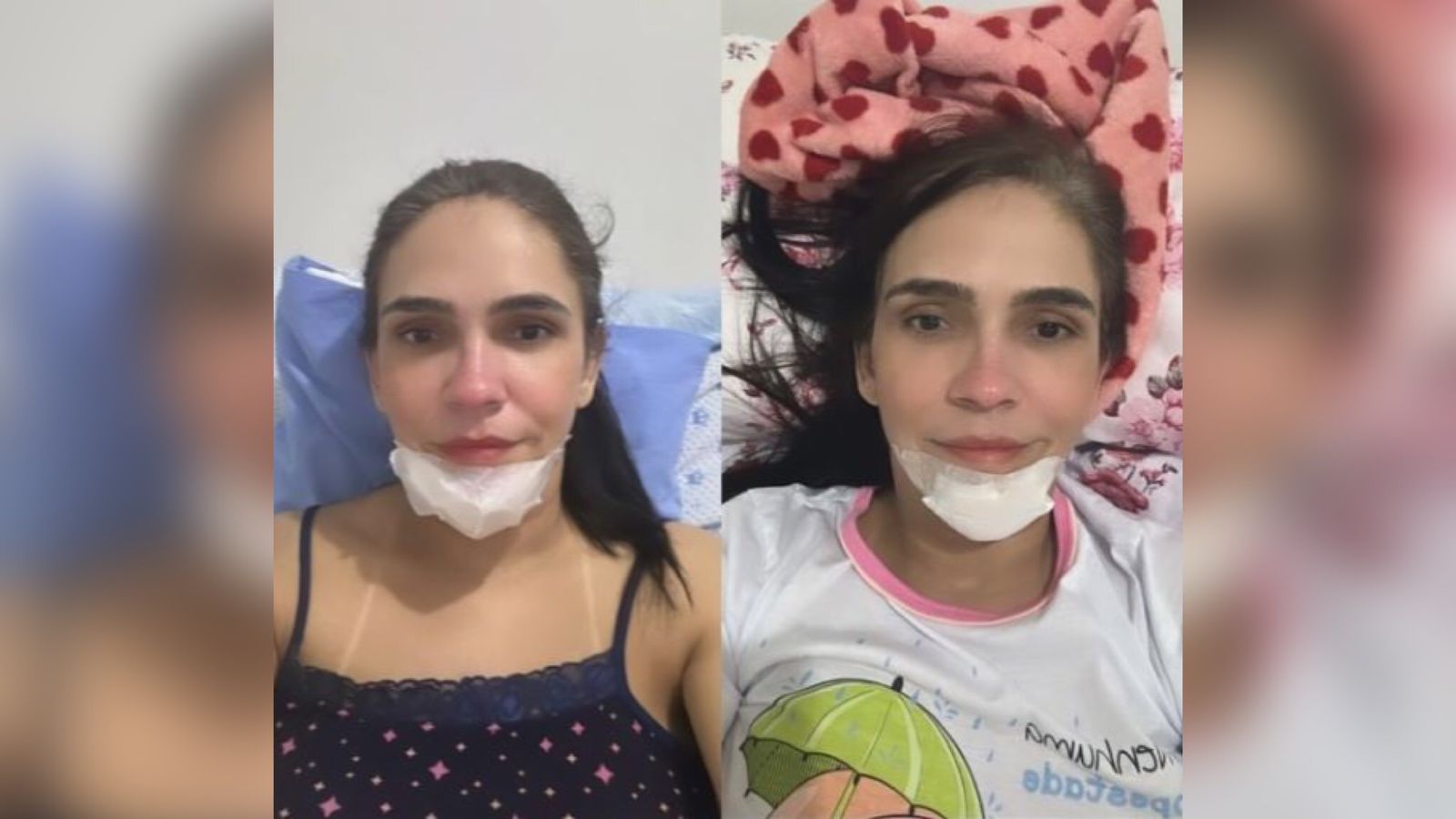 Enfermeira patoense Rayanne Dantas, vítima de grave acidente em ambulância do SAMU, fazer relato de superação nas redes sociais