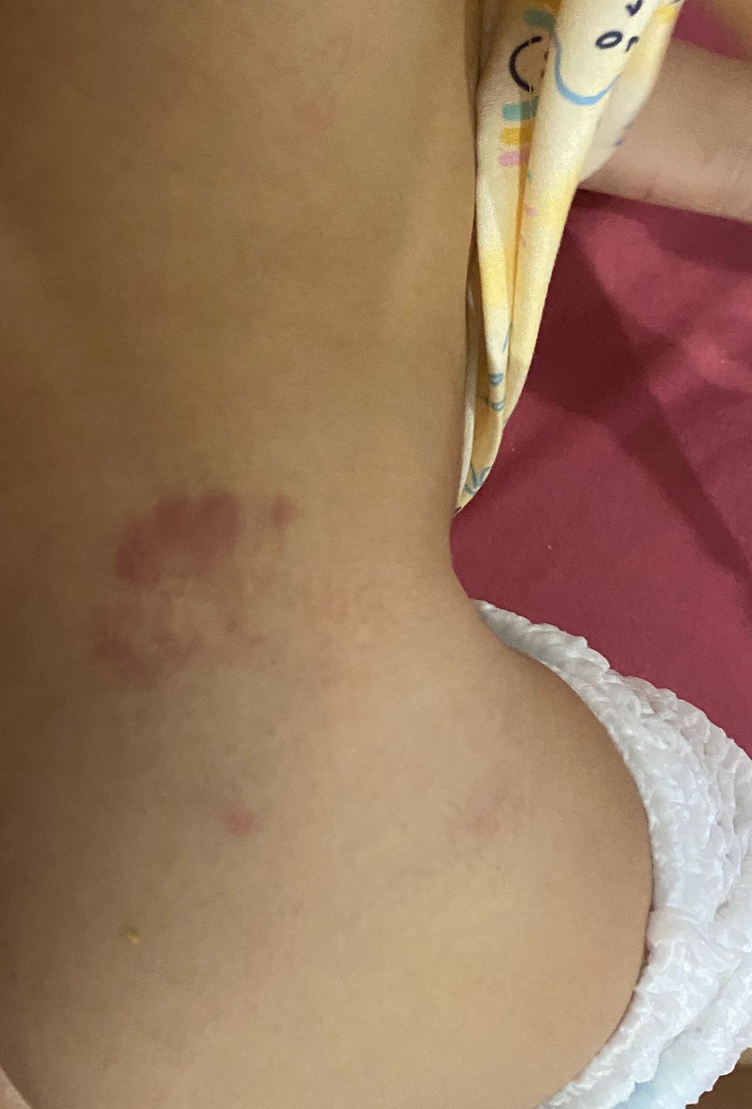 Mãe relata que filha de 2 anos foi mordida por cães de vizinha enquanto estava brincando na calçada de casa, no Centro de Patos