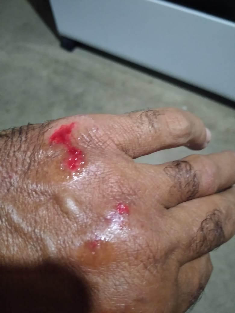 Motociclista sofre acidente após colidir com cachorro no bairro Belo Horizonte, em Patos