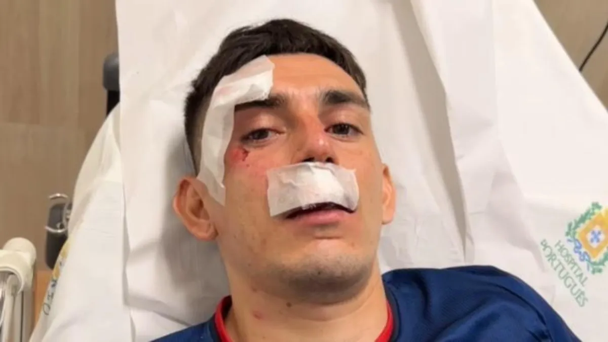 Ônibus do Fortaleza é atacado com bomba após partida contra o Sport pela Copa do Nordeste e deixa jogadores e membros da comissão feridos