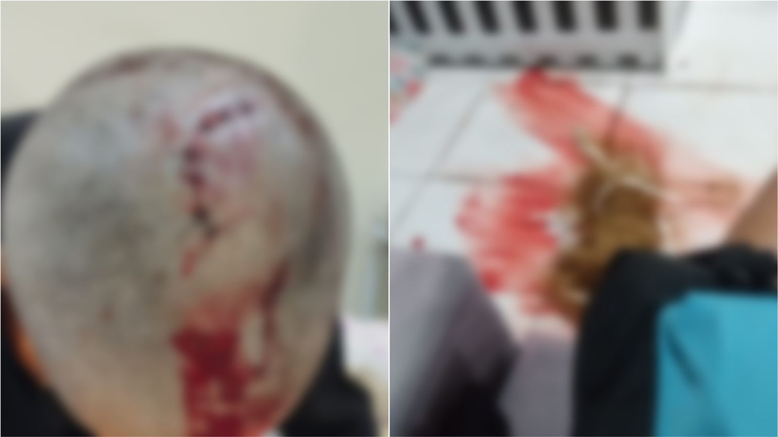 Homem é preso em Campina Grande suspeito de torturar a ex-esposa: 'ele armou tudo', desabafa a vítima