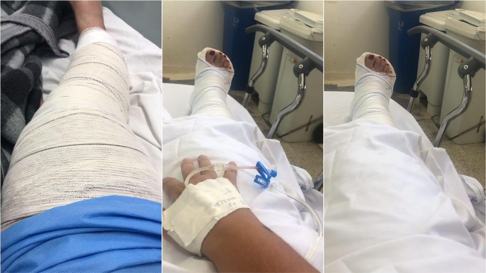 Jovem de Santa Gertrudes que reside no RJ, realiza Rifa Beneficente para custear despesas médicas após acidente que a deixou sem trabalhar