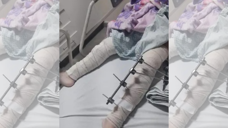 MPPB instaura procedimento para apurar “erro médico” contra criança em CG