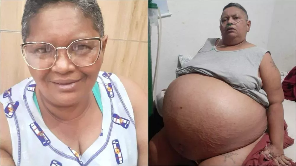 Após três anos lutando para retirada de mioma, patoense Francisca Núbia não resiste e morre 