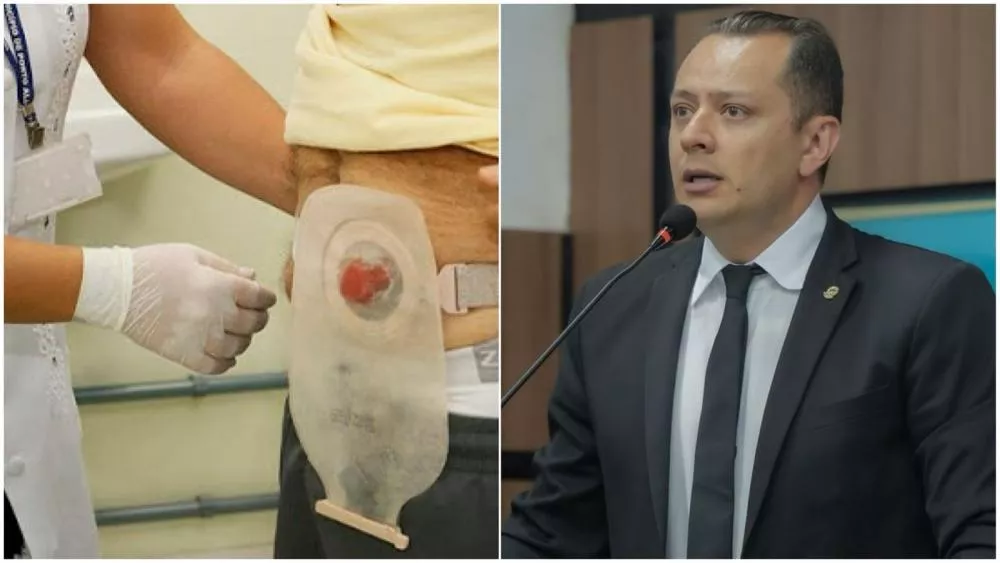 Josmá Oliveira defende prioridade em filas para pessoas ostomizadas e diz que apresentará Projeto de Lei