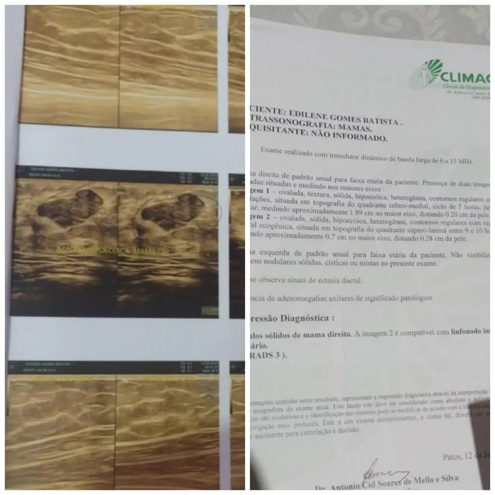 Jovem de 23 anos residente em Teixeira lança campanha para conseguir custear cirurgia de retirada de nódulo na mama