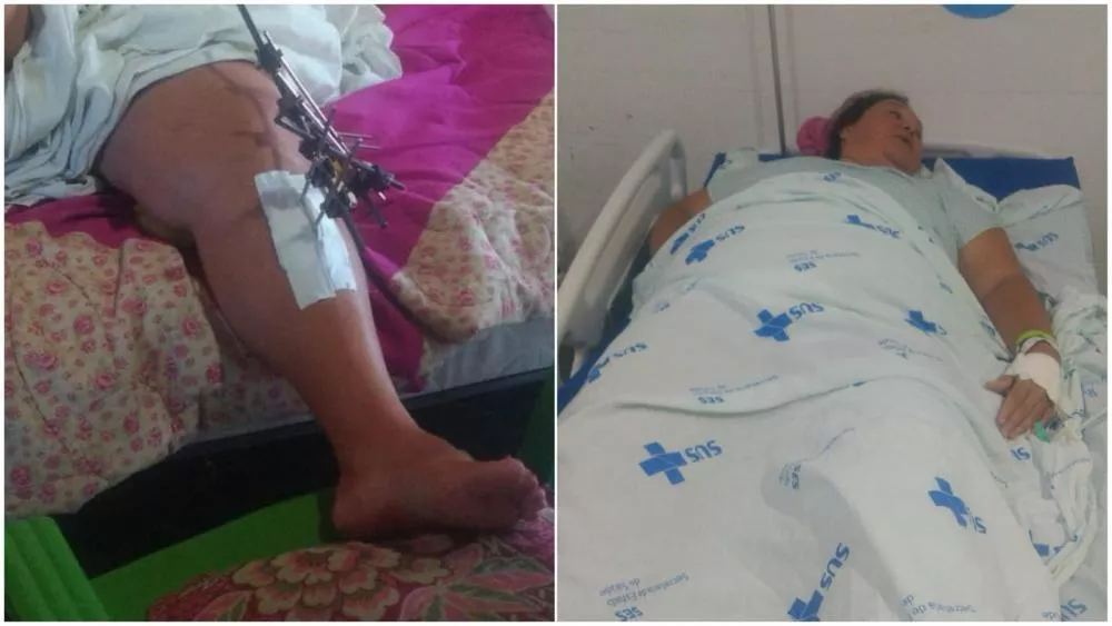 Familiares de Maria Vilma Souza fazem apelo por ajuda para tratamento de saúde