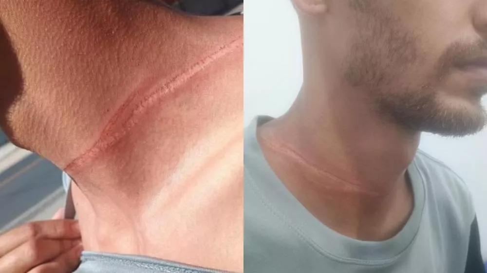 Foto: Reprodução/Patosonline