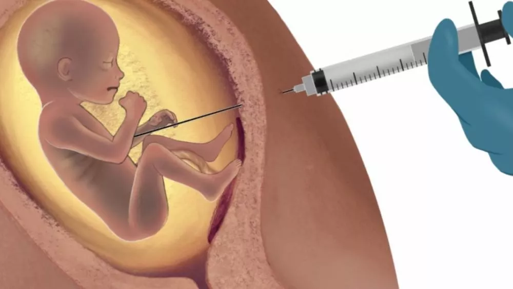 CCJ da Câmara aprova PEC que pode acabar com o aborto legal no Brasil