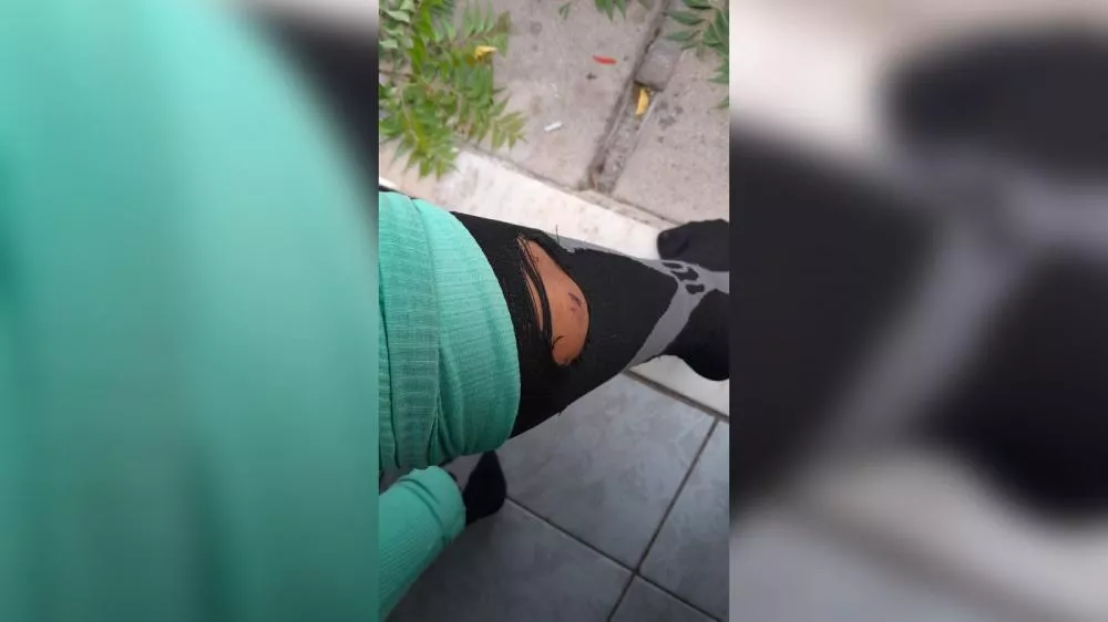 Motociclista relata ataque de cães enquanto se deslocava para corrida na Alça, em Patos