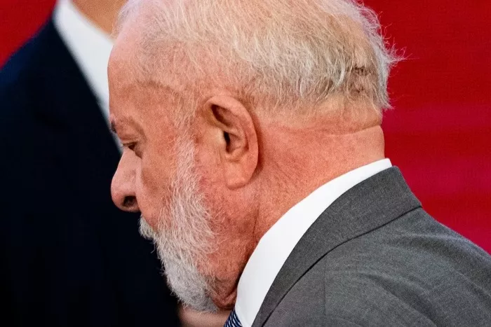 Lula está estável e sem sequelas após cirurgia no cérebro, diz equipe médica