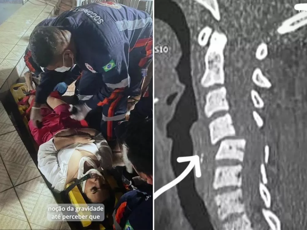 Neurocirurgião alerta para riscos de mergulho em piscinas/ambientes com águas rasas durante o verão