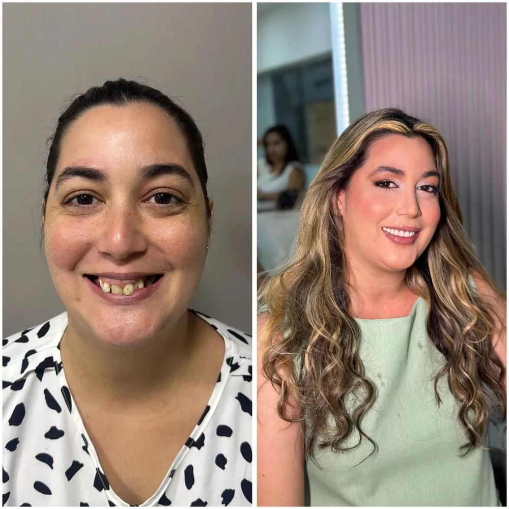 Sorrir novamente: o impacto transformador do atendimento humanizado do Dr. Arthur Lira