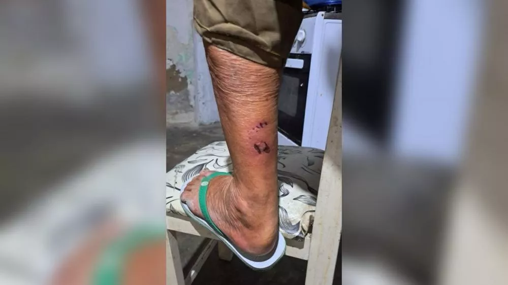 Mulher relata que idoso foi atacado por cães de rua no Jatobá e cobra providência das autoridades