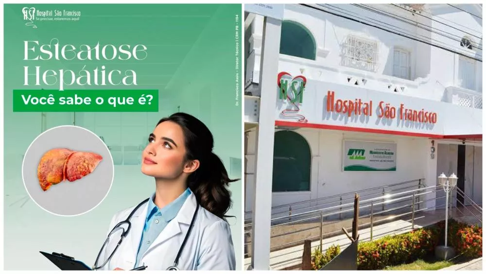 Hospital São Francisco orienta sobre os riscos da gordura no fígado e como prevenir