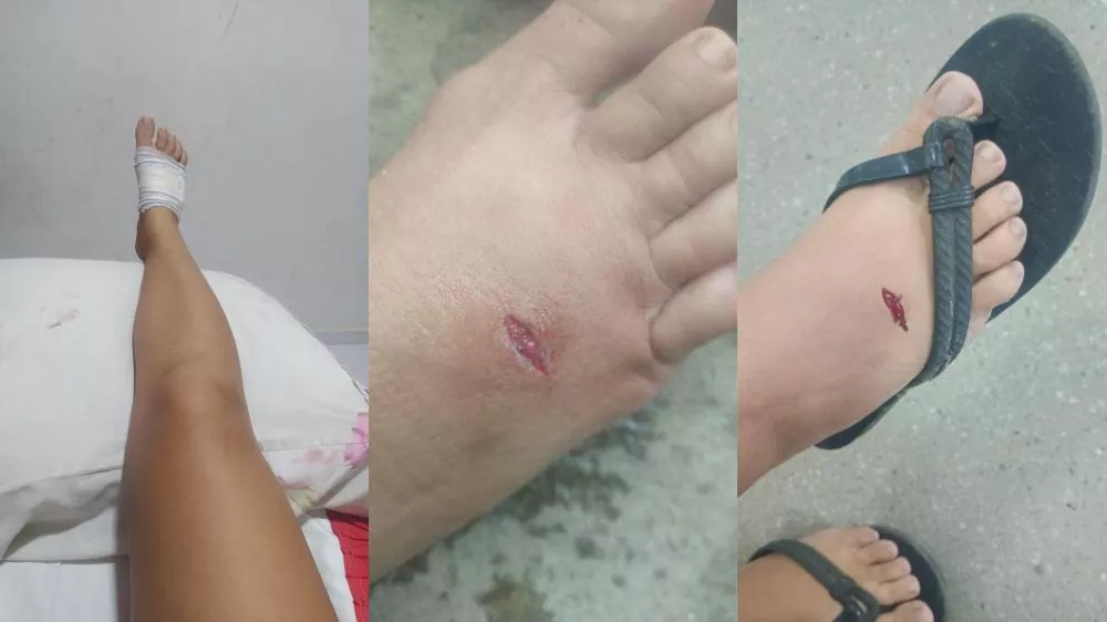 Vendedora de bolos relata ter sido atacada por cão enquanto realizava entrega no bairro Jatobá e cobra providências